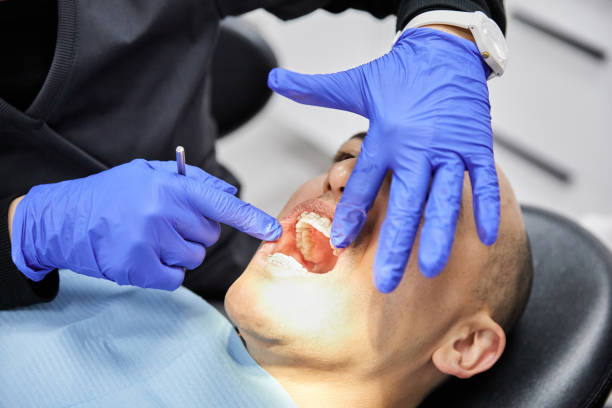 Best Emergency Treatment for Dental Infections or Abscesses in Dawson Springs, KY